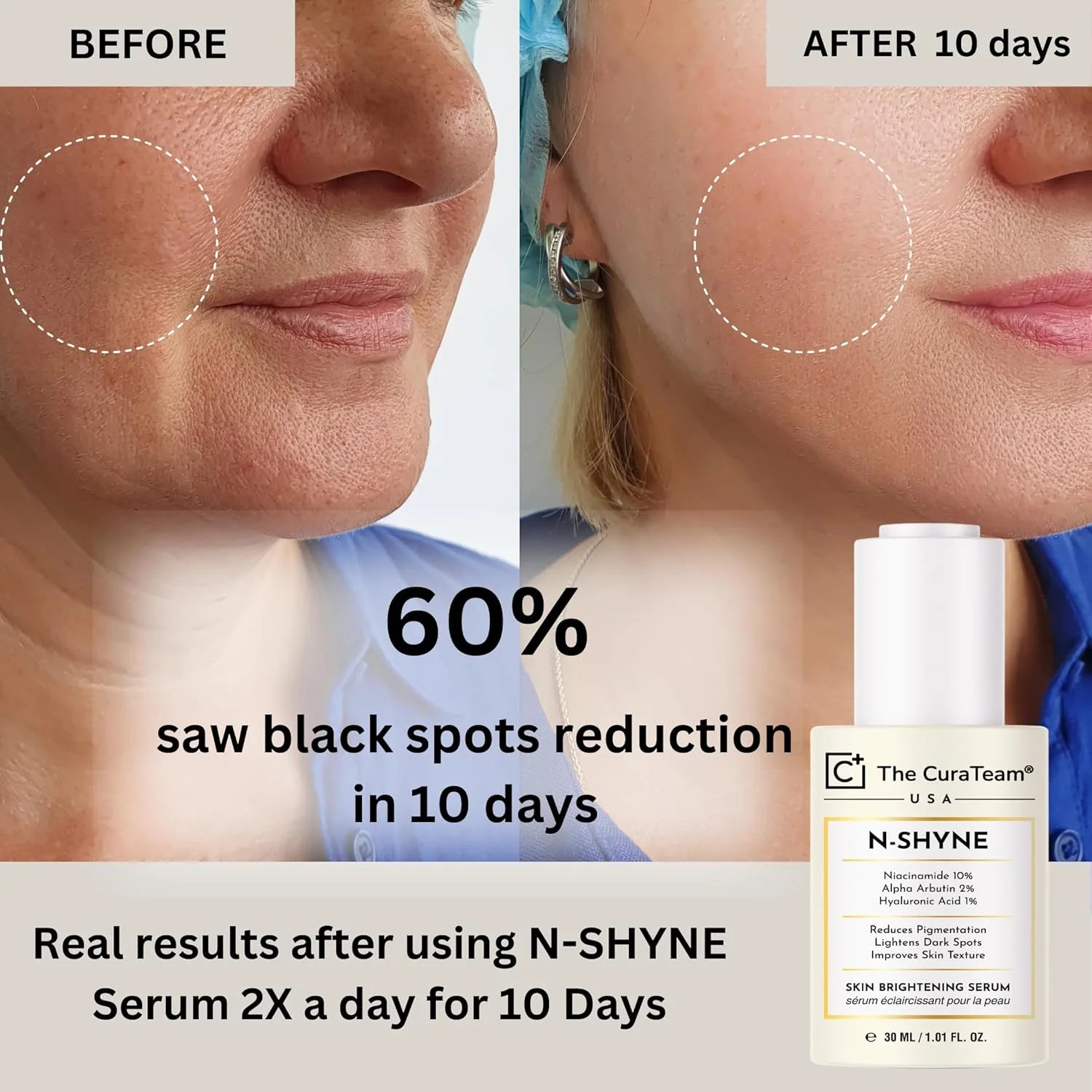 10% Niacinamide Brightening Serum (USFDA Approved)