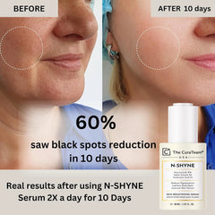 10% Niacinamide Brightening Serum (USFDA Approved)