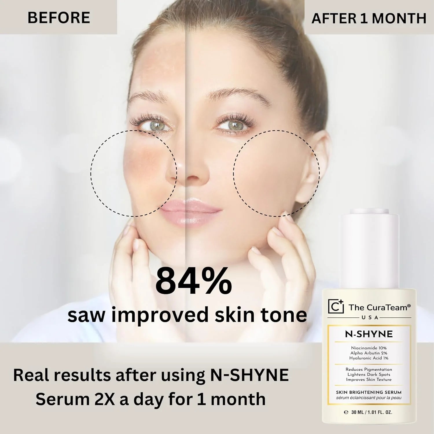 10% Niacinamide Brightening Serum (USFDA Approved)