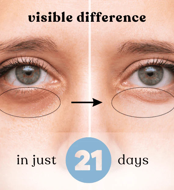 EZYROLL™ Under Eye Roll On Serum